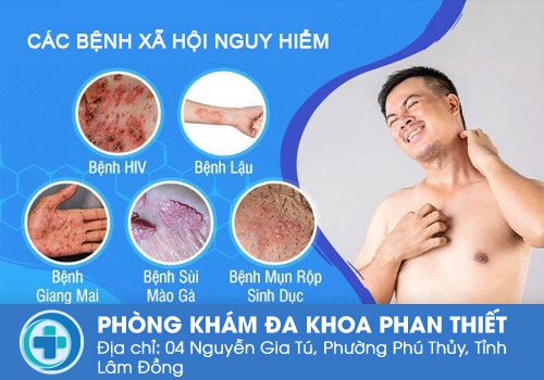 Các căn bệnh xã hội nguy hiểm thường gặp hiện nay.