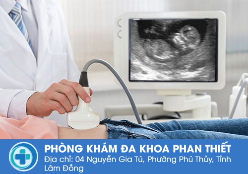 Siêu âm thai là gì? Giải đáp các vấn đề về siêu âm thai Siêu âm thai là gì? Giải đáp các vấn đề về siêu âm thai