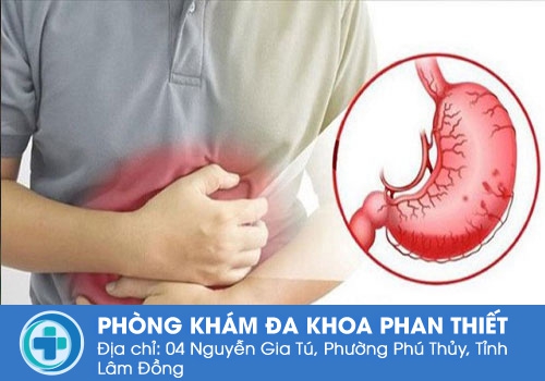 Thói quen uống nước sau đây không ngờ có thể gây hại cho sức khỏe Thói quen uống nước sau đây không ngờ có thể gây hại cho sức khỏe