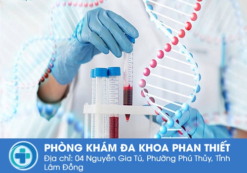 Xét nghiệm tổng quát máu cần lưu ý những gì? Xét nghiệm tổng quát máu cần lưu ý những gì?