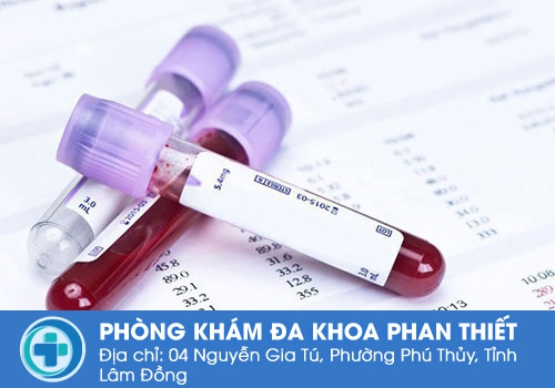 Xét nghiệm tổng quát máu cần lưu ý những gì? Xét nghiệm tổng quát máu cần lưu ý những gì?