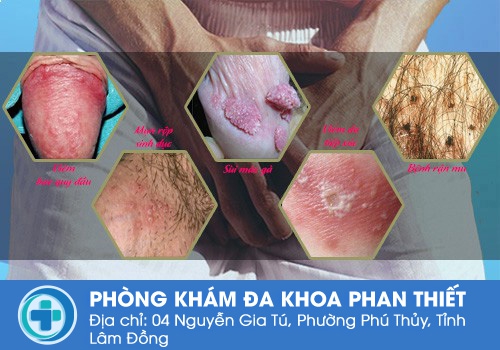 Nguyên nhân bệnh lý dẫn đến bị ngứa vùng kín ở nam giới