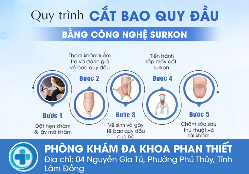Các bước trong quy trình cắt bao quy đầu