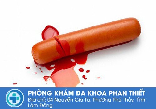 dương vật chảy máu