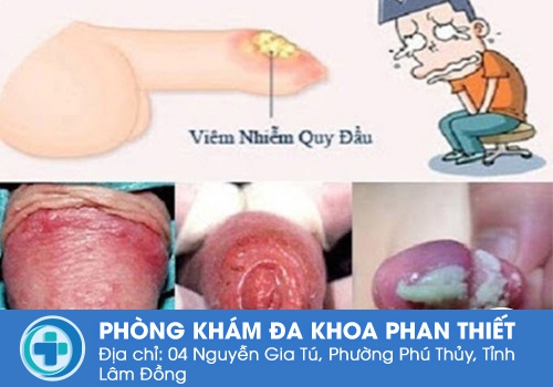 Viêm nhiễm là một trong những mối nguy thường gặp khi dây hãm bị đứt