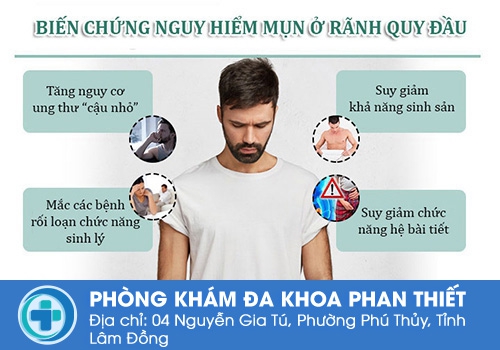 Chuỗi hạt ngọc dương vật có nguy hiểm không?