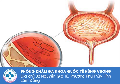 Địa chỉ khám bàng quang tốt ở TPHCM Địa chỉ khám bàng quang tốt ở TPHCM