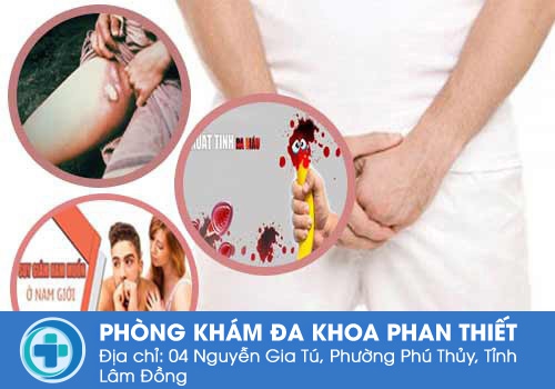 Những tác hại nguy hiểm của việc nổi hạch ở vùng kín