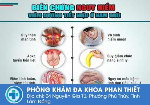 Bệnh đường tiết niệu để lại rất nhiều hệ lụy, trong đó vô sinh là một trong số đó