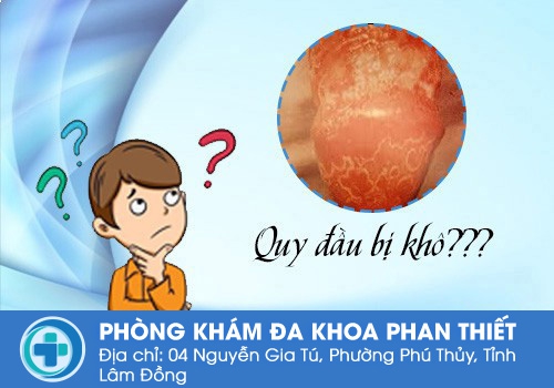 Quy đầu bị khô là do đâu