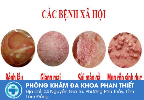 Các bệnh lý xã hội