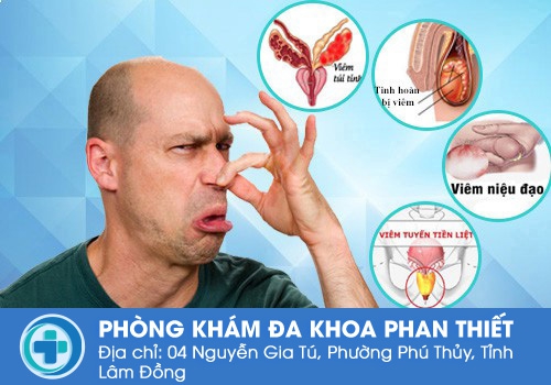Một trong các bệnh lý trên có thể dẫn đến tinh trùng có mùi hôi ở nam giới