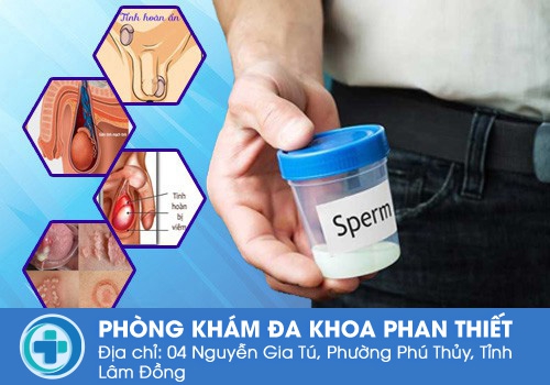 Các nguyên nhân dẫn đến nam giới bị tinh trùng loãng