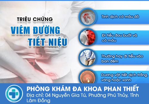 Hình ảnh về viêm bàng quang
