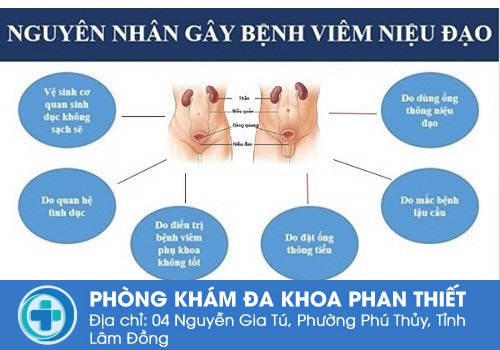 Nguyên nhân gây bệnh viêm niệu đạo ở nam và nữ