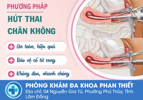 Ưu điểm của phương pháp hút thai chân không.