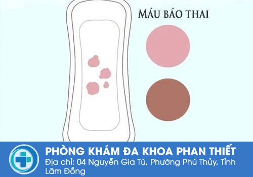 Màu sắc của máu báo thai.