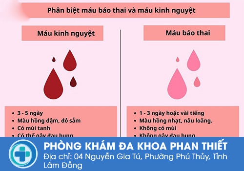 Phân biệt máu báo thai và máu kinh nguyệt.