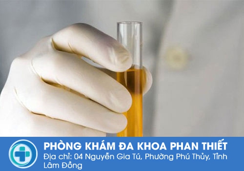 Cách lấy nước tiểu đúng cách để thực hiện xét nghiệm Cách lấy nước tiểu đúng cách để thực hiện xét nghiệm
