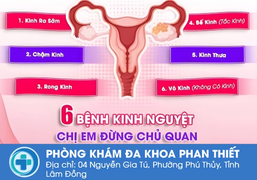 Các dấu hiệu kinh nguyệt thất thường.