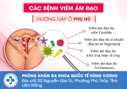 Các bệnh viêm âm đạo thường gặp.