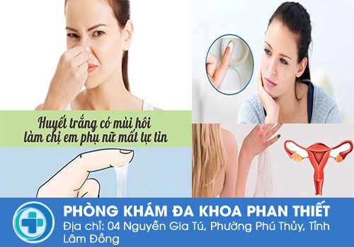 Nguyên nhân huyết trắng có mùi hôi là gì?