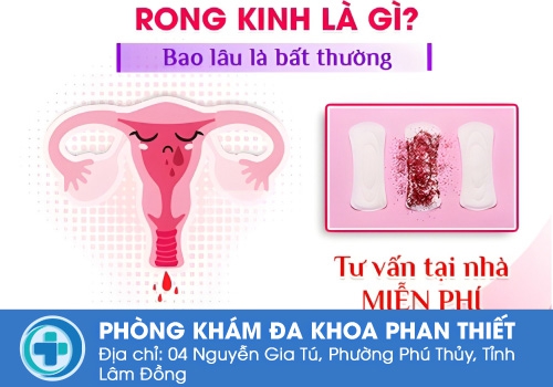 Khi nào được gọi là rong kinh?